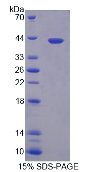 SDS-PAGE